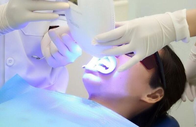 Tẩy trắng răng bằng công nghệ laser hiện đại