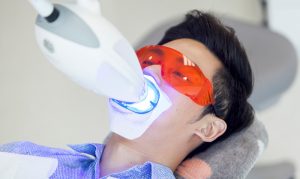 Tiến hành tẩy trắng răng
