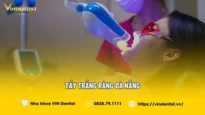 Tẩy trắng răng Đà Nẵng
