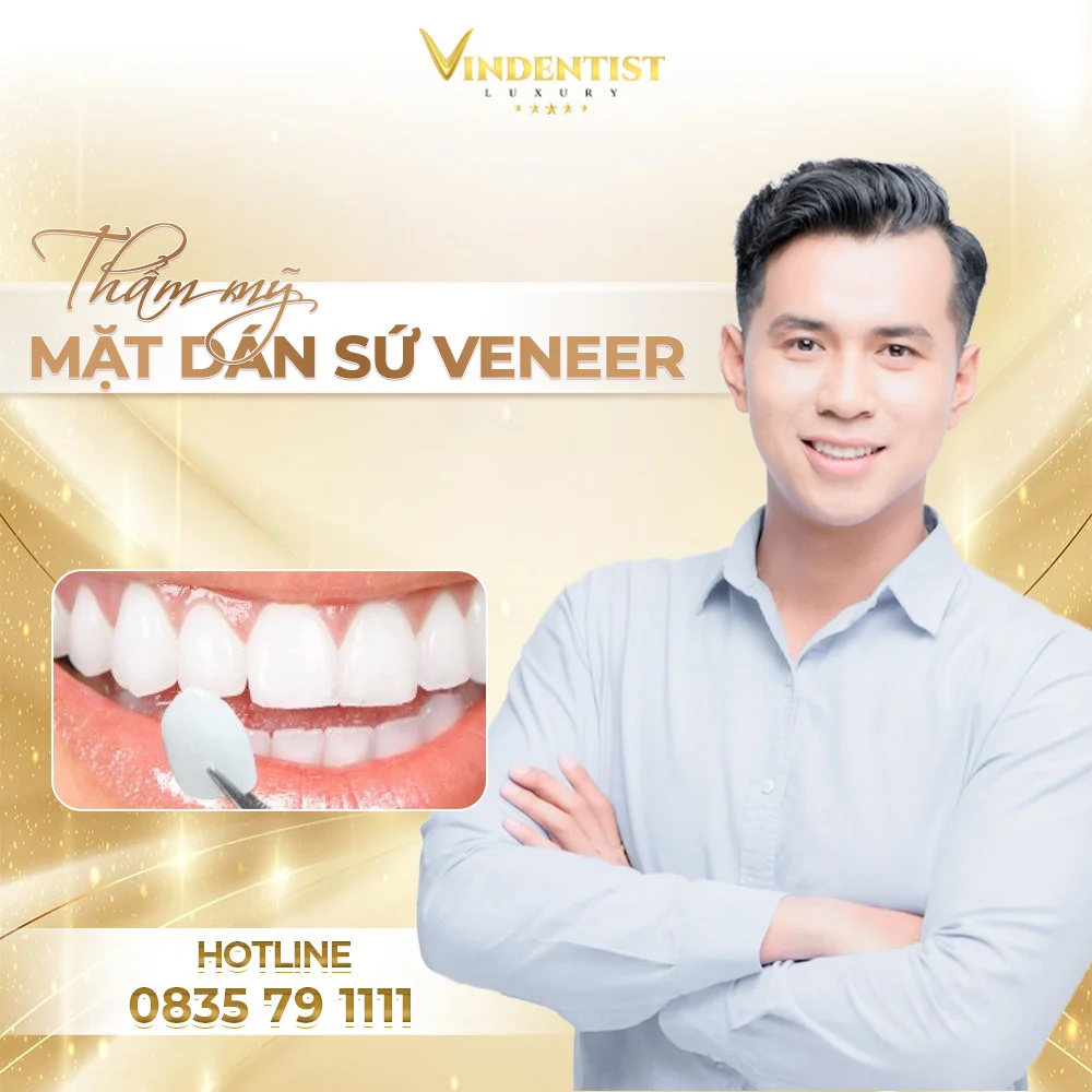 Dán răng rứa veneer Đà Nẵng - Nha Khoa VIN Dentist