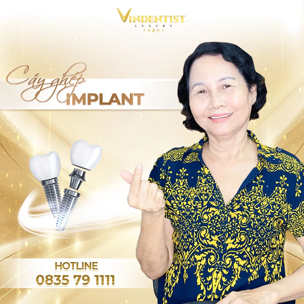 Cấy ghép IMPLANT tại Đà Nẵng ở Nha Khoa VIN DENTIST