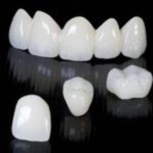 Sứ Cercon HT