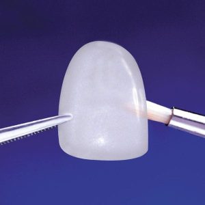 Veneer Emax