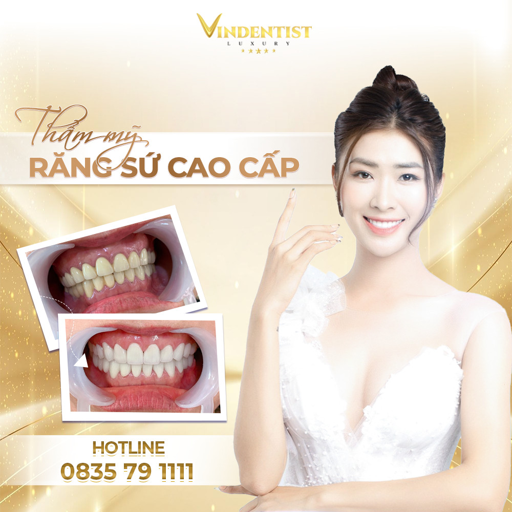 Bọc răng sứ tại Nha Khoa VIN Dentist Đà Nẵng