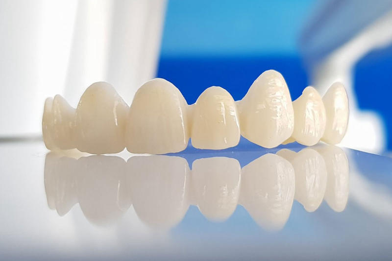 Bọc răng sứ zirconia có tốt không?