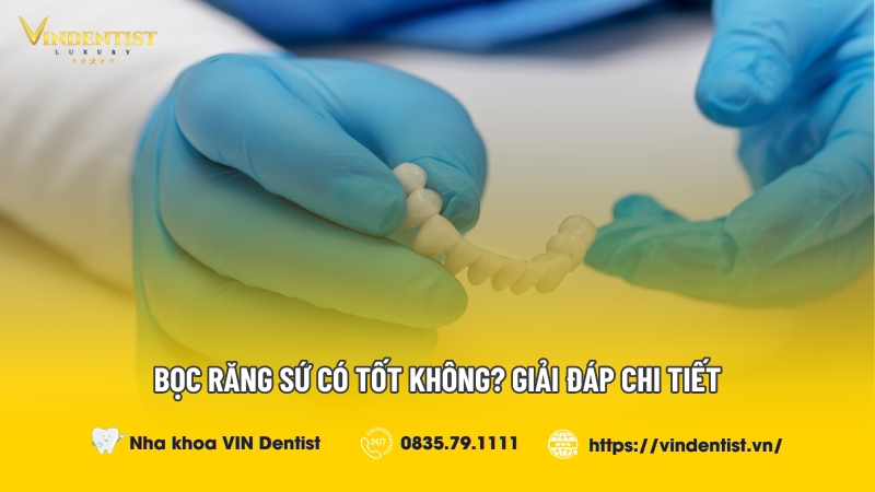 Bọc răng sứ có tốt không? Nha Khoa VIN Dentist Đà Nẵng