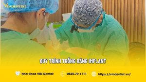 Quy trình trồng răng implant