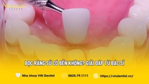 Bọc răng sứ có bền không? - Nha Khoa VIN Dentist Đà Nẵng