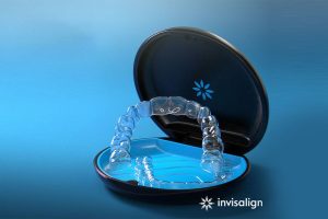 Niềng răng khay trong suốt Invisalign