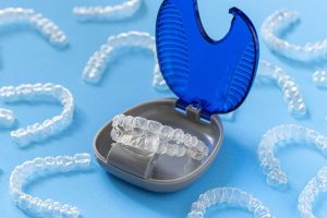 Giá niềng răng trong suốt dao động từ 25-65 triệu