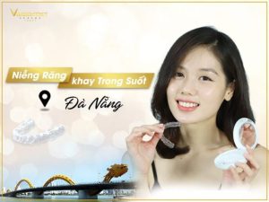 Liên hệ nhận tư vấn niềng răng Leetray Đà Nẵng uy tín ngay!
