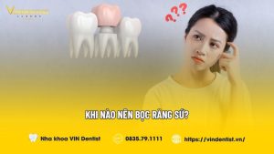 Khi nào nên bọc răng sứ