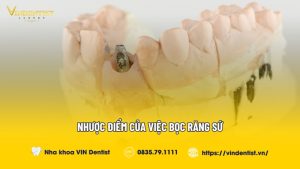 Nhược Điểm Của Việc Bọc Răng Sứ - Nha Khoa VIN Dentist Đà Nẵng