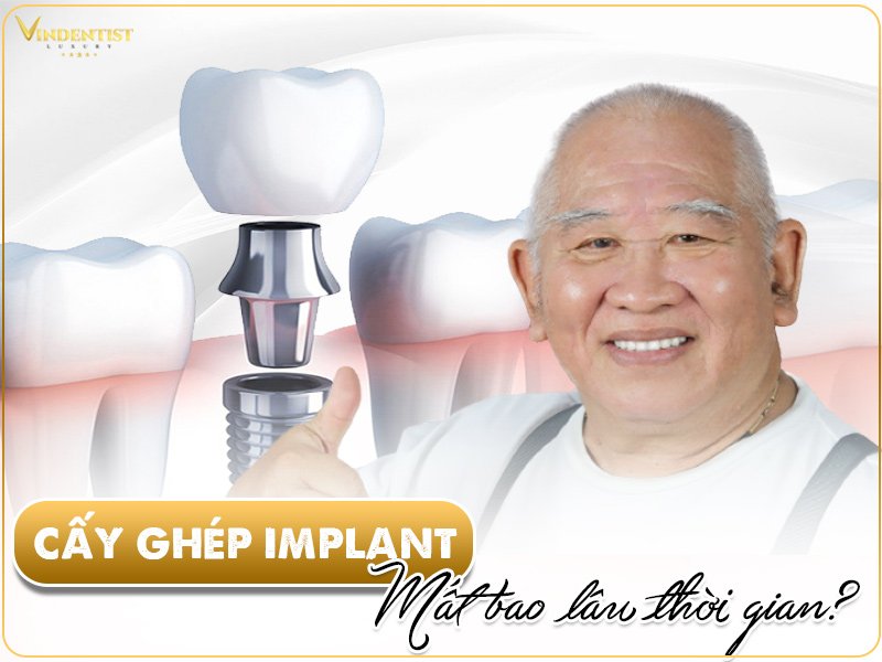 Nha Khoa VIN Dentist - Chuyên gia cấy ghép implant hàng đầu Đà Nẵng