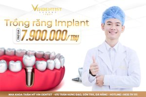 Chi phí rõ ràng, minh bạch
