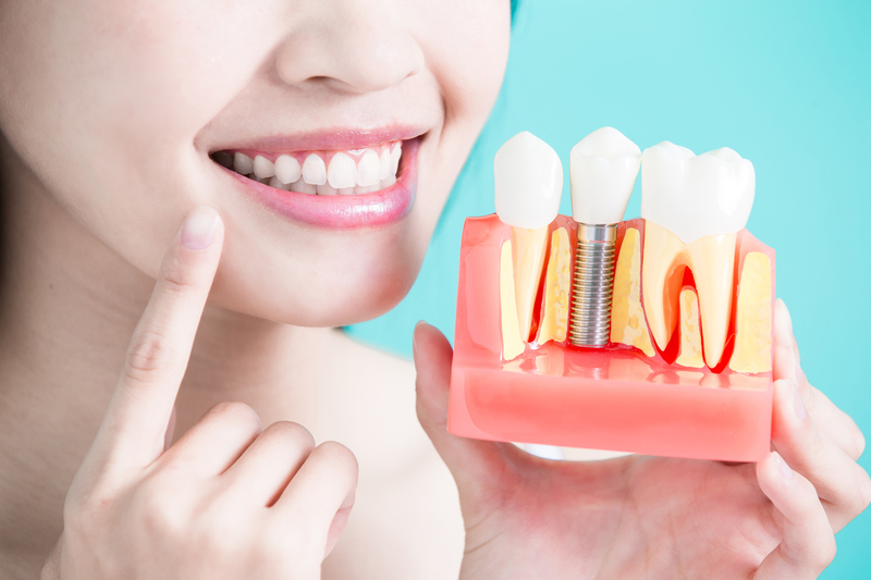 Giá trồng răng implant