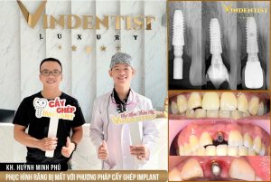 Bác sĩ Nguyễn Văn Thăng tại VIN Dentist