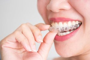 Niềng răng invisalign Đà Nẵng