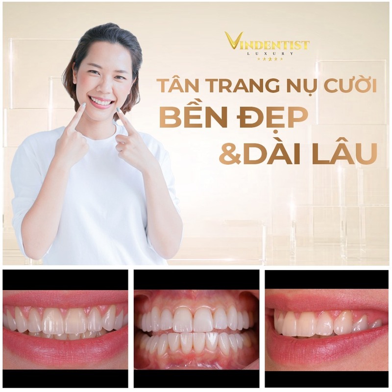 Bọc răng sứ ở Đà Nẵng tại Nha Khoa VIN Dentist