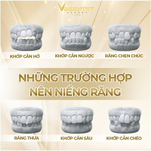 Những trường hợp nên niềng răng