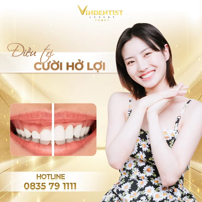 Dịch Vụ Điều Trị Cười Hở Lợi Đà Nẵng Uy Tín, Không Tái Phát 19 Tự tin với nụ cười xinh cùng VIN Dentist