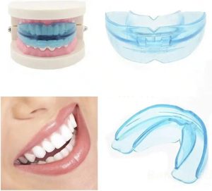 Niềng răng tại nhà