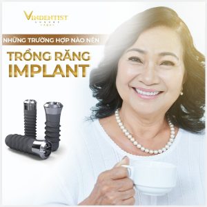 Liên hệ VIN Dentist để được tư vấn miễn phí