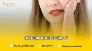 Biến chứng sau khi bọc răng sứ