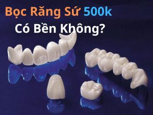 bọc răng sứ 500k