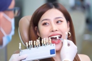 Bọc răng sứ sai kỹ thuật