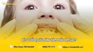 bé 5 tuổi bị sâu răng hàm phải làm sao