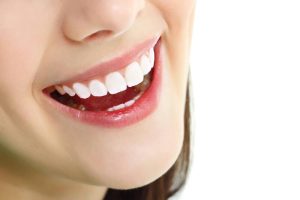 Tính thẩm mỹ cao, màu sắc giống răng thật