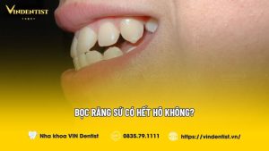Bọc răng sứ có hết hô không