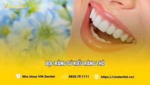 Bọc răng sứ kiểu răng thỏ