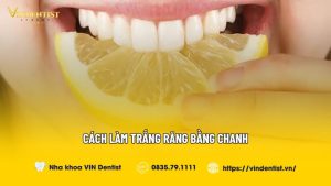 Cách Làm Trắng Răng Bằng Chanh