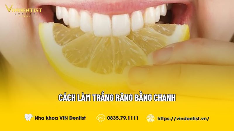 Cách Làm Trắng Răng Bằng Chanh