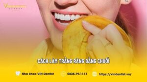 Cách Làm Trắng Răng Bằng Chuối Có Hiệu Quả Như "Lời Đồn"?