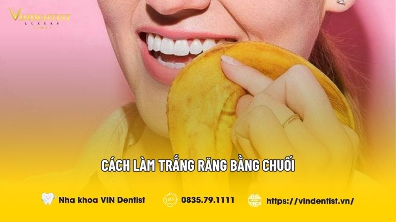 Cách Làm Trắng Răng Bằng Chuối Có Hiệu Quả Như "Lời Đồn"?