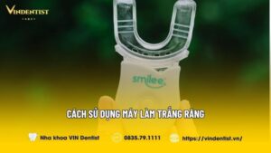 Cách Sử Dụng Máy Làm Trắng Răng Tại Nhà Đúng Cách