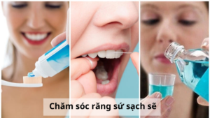Chăm sóc răng sứ sạch sẽ