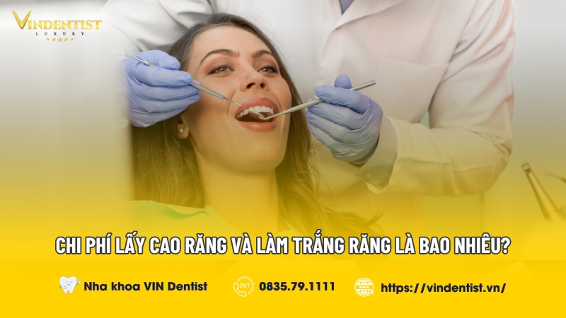 Chi Phí Lấy Cao Răng Và Làm Trắng Răng