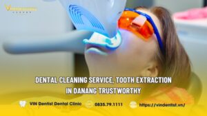 dental cleaning in danang