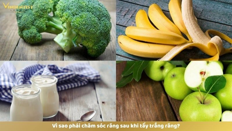 Làm Gì Sau Khi Tẩy Trắng Răng? 10 Điều chỉnh chế độ ăn uống