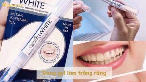 Dùng gel làm trắng răng