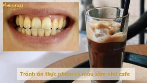 Hạn chế dùng thức uống gây ố vàng