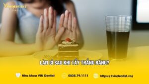 Làm Gì Sau Khi Tẩy Trắng Răng? | Nha khoa VIN Dentist