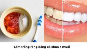Làm trắng răng bằng cà chua + muối