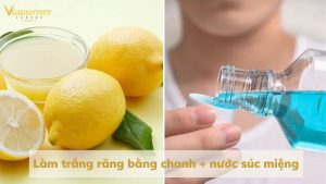 Làm trắng răng bằng chanh + nước súc miệng