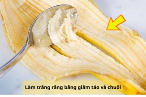 Làm trắng răng bằng giấm táo và chuối