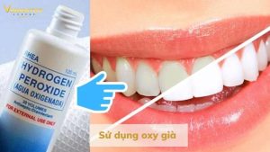Làm trắng răng bằng oxy già